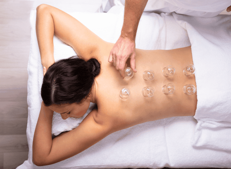 A person lying face down on a massage table receives cupping therapy, with several glass cups placed on their bare back, while the practitioner also incorporates soothing shiatsu techniques to enhance the treatment.