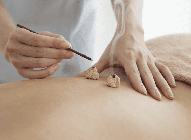 Moxibustion