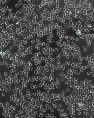Microscopic view of numerous small, round cells on a dark background, appearing densely clustered together.