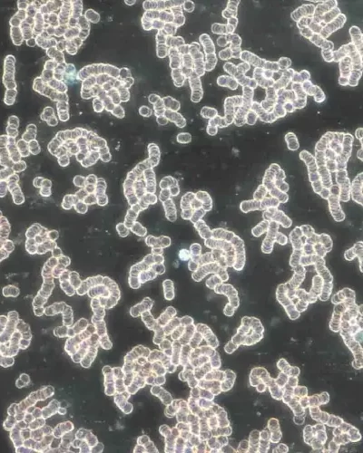 Close-up of chromosomes viewed under a microscope, displaying coiled and knotted structures against a dark background.